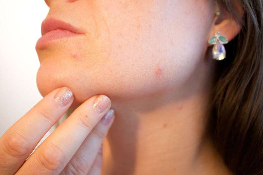 Jak znaleźć dobrego dermatologa?