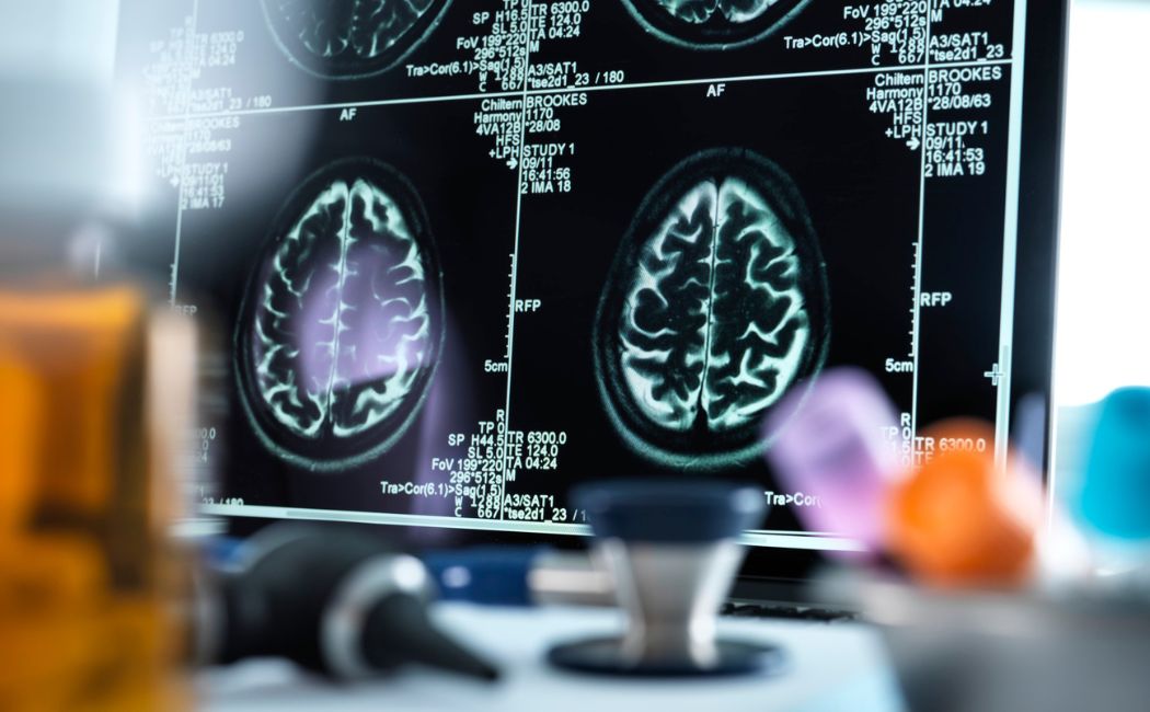 Przygotowanie dziecka do badania TK lub MRI: Czego się spodziewać i jak zachować środki ostrożności